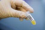 Genomic Diagnostic Tests Face Persistent Pricing And Reimbursement Challenges