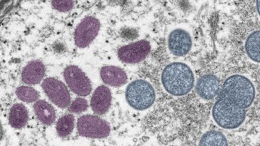 Moneypox Virus DNA Found In Semen Of 5 Men, WHO Investigating Further