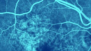 Preserving Sight Through Innovation