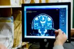 The Brain Technology Treating Neurological Disorders That Will Benefit From AI