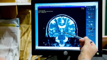 The Brain Technology Treating Neurological Disorders That Will Benefit From AI