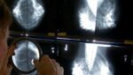 New Study Shows How AI Can Help Detect Breast Cancer