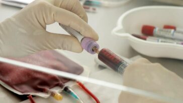 Can Alzheimer’s Disease Be Transmitted By Blood And Organ Donations?