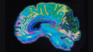 The Cerebellum Has a Function We Didn't Even Know About, New Research Reveals : ScienceAlert