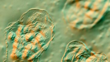 Measles Strikes a Florida Elementary School With Over 100 Unvaccinated Kids