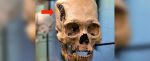 Mysterious Skull Implanted With Strange Metallic Object Divides Experts