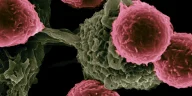 Revolutionary Cancer Treatment for Autoimmune Disease