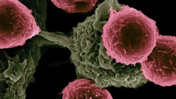 Revolutionary Cancer Treatment for Autoimmune Disease