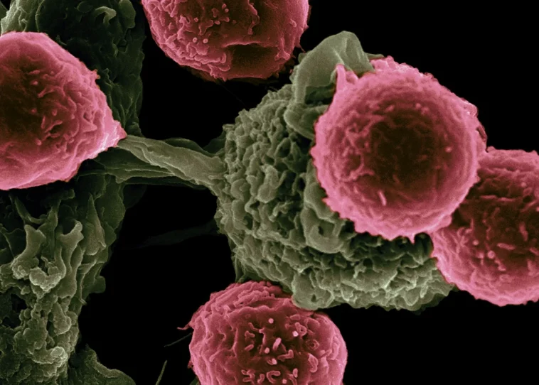 Revolutionary Cancer Treatment for Autoimmune Disease