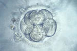 Precise Gene Editing in Embryos: 'Designer Baby' Debate Precise Gene Editing in Embryos: 'Designer Baby' Debate
