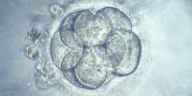Precise Gene Editing in Embryos: 'Designer Baby' Debate