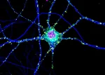 Huntington's: Toxic Clumps May Protect Brain Too