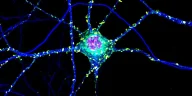 Huntington's: Toxic Clumps May Protect Brain Too