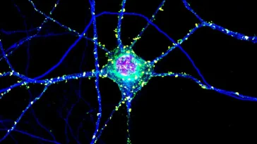 Huntington's: Toxic Clumps May Protect Brain Too