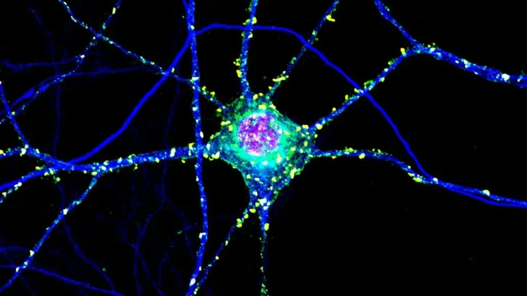 Huntington's: Toxic Clumps May Protect Brain Too