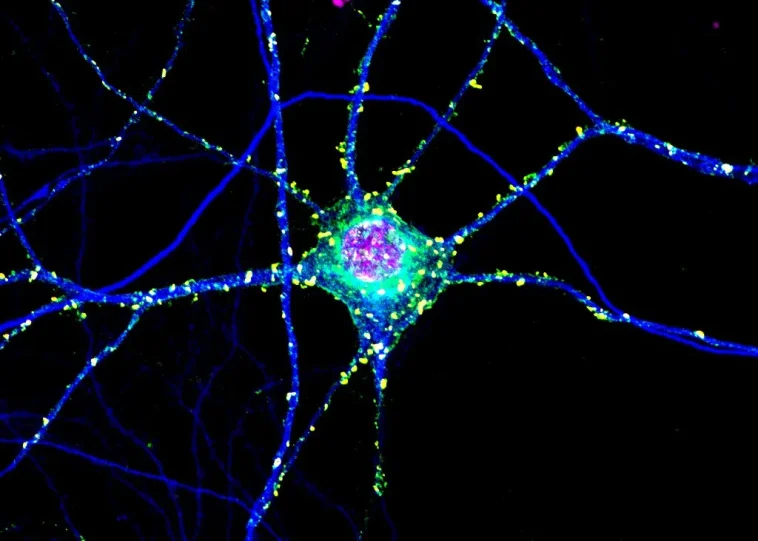 Huntington's: Toxic Clumps May Protect Brain Too