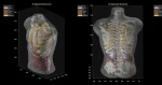 Midjourney Medical: AI Images to Full-Body Ultrasounds Midjourney Medical: AI Images to Full-Body Ultrasounds
