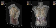 Midjourney Medical: AI Images to Full-Body Ultrasounds