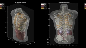 Midjourney Medical: AI Images to Full-Body Ultrasounds