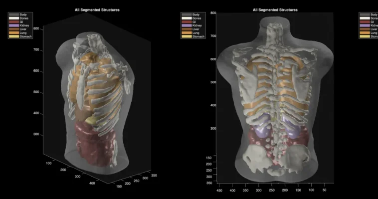 Midjourney Medical: AI Images to Full-Body Ultrasounds