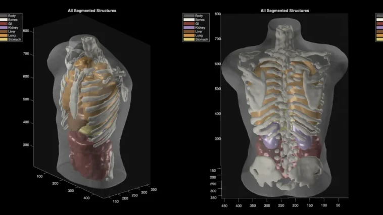Midjourney Medical: AI Images to Full-Body Ultrasounds